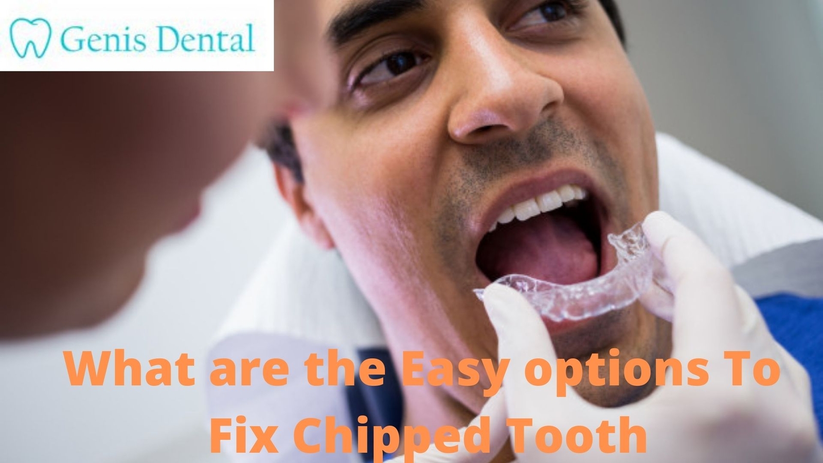 What Are The Easy Options To Fix Chipped Tooth By Oleg Genis On Dribbble   What Are The Easy Options To Fix Chipped Tooth 4x 