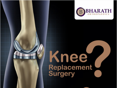 Knee Replacement Surgery In Chennai By Bharath Orthopaedics On Dribbble