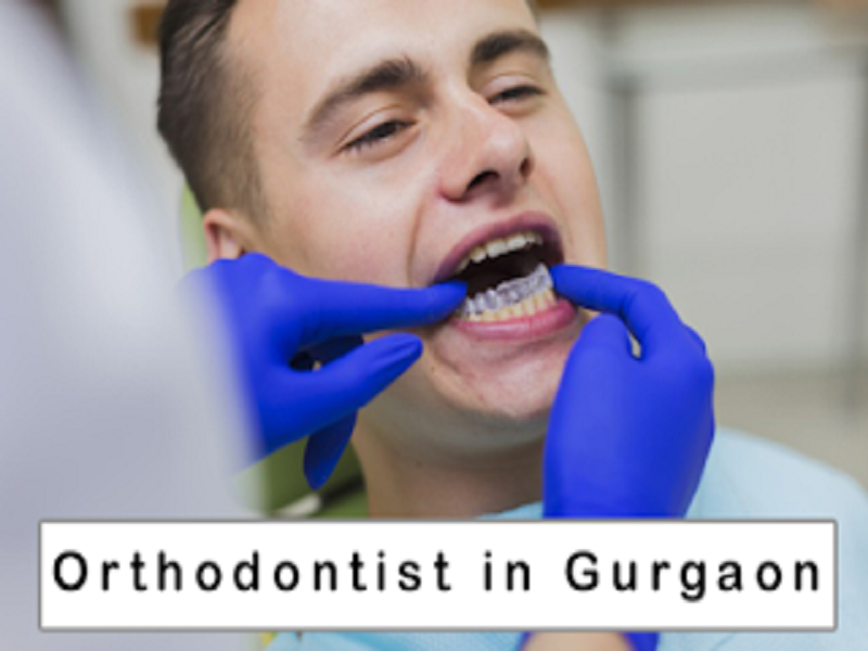 Best Orthodontist in Gurgaon by chadhadrvineet on Dribbble