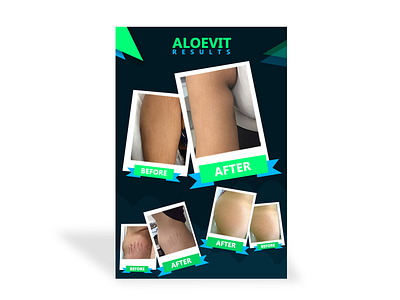 aloevit before & after design