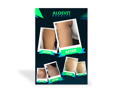 aloevit before & after