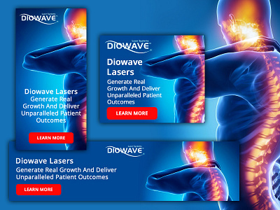 Banners for Diowave Laser adobe photoshop ads ads design banner ad banner design banners branding design photoshop web