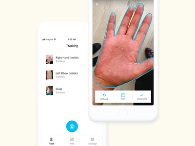 Imagine - Skin Tracking App android app daily design edit healthcare interface ios med medical medtech mobile photo picture progress project skin tech tracking