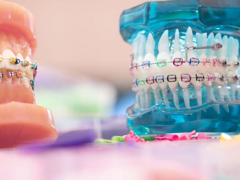 Orthodontic Smile Studio by Orthodontic Smiles Guide on Dribbble