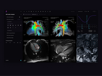 MRI Soft