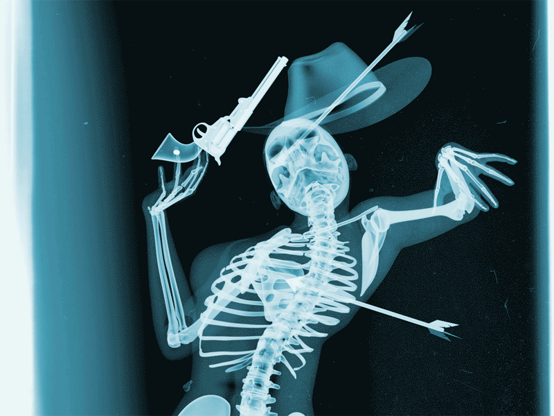 X-Ray 3d anatomy animation arrow cgi cowboy gif gun illustration medical x-ray