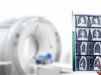 research topics diagnostic imaging