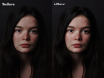 PhotoRetouching blemish remove high end retouching photoshop retouching skin retouch skin tone