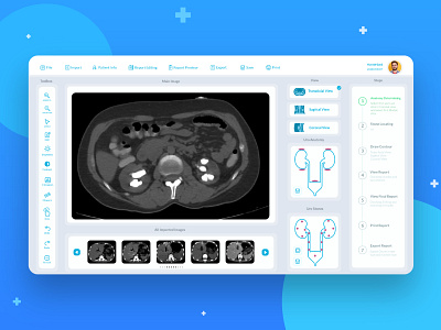 CT scan desktop app app appdesign branding design desktop app icon identity design illustration medical typogaphy typography ui user experience user interface ux web website