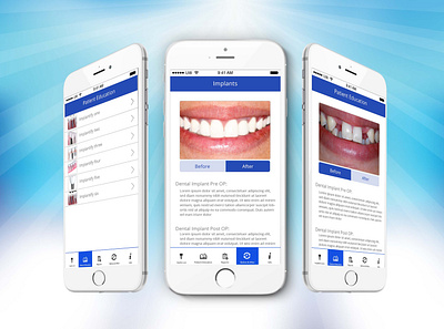 Implantoo - Dental Scanning App app design