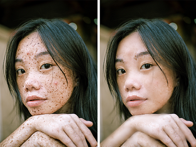 Blemishes Removed, High end Retouching