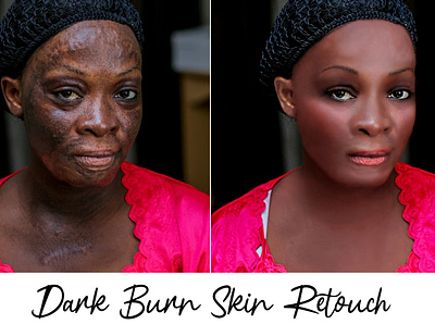 Dark Burn Skin Retouch adobe adobe photoshop background beautyphotography clean design dribbble editorial face fiverr freelancer graphic graphic design people photoretouching portrait poster rahat150 retouching