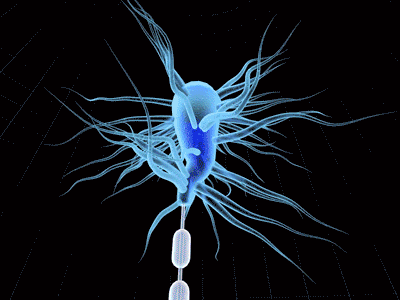 Diffuse Axonal Brain Injury Part 2 animation axon medical mograph motion graphics