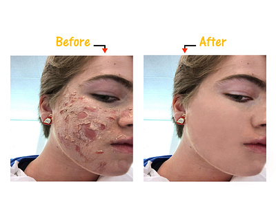 spot healing + face brighten art before after before and after bright brightness edit editing healing healing brush photo photoshop spot healing