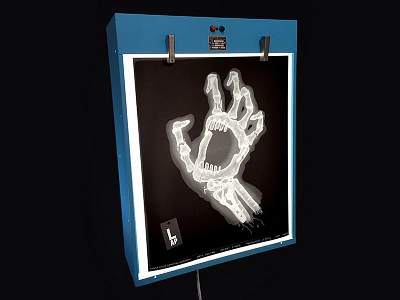 everything was broken and nothing didn't hurt bones broken hand lightbox screaming hand skateboard x ray