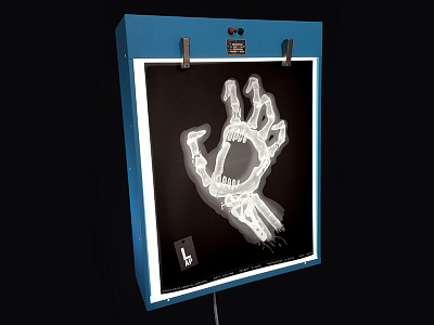 everything was broken and nothing didn't hurt bones broken hand lightbox screaming hand skateboard x ray