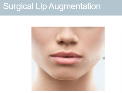 Surgical Lip Augmentation | Plastic surgery dubai by Dr. Kayle