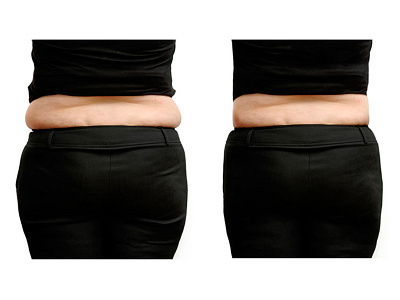 Body slimming slim down tummy tuck enhance body enhance photo photo editing photoshop slim down tummy tuck