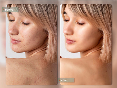 Before - after skin retouching adobe photoshop beauty retouch digital imaging fashion graphic design highend retouch image retouching photo compositing photo editing portrait skin retouch