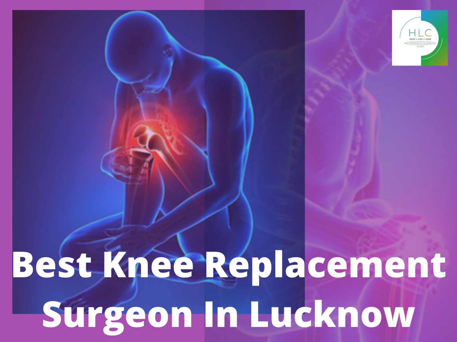 Best Knee Replacement Surgeon In Lucknow By Hope Life Care On Dribbble