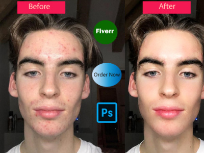 Remove acne, scars, pimples, editing, and high end retouching acne removal design graphic design photoshop