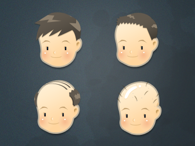 How men lose their hair.... bald illustration