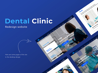 Redesign website for Dental clinic artschool webdesign uxui design branding dental webdesign design design dental clinic site illustration khmeliardesign logo minimal redesign redesign ui ux website ui ux uxui design web