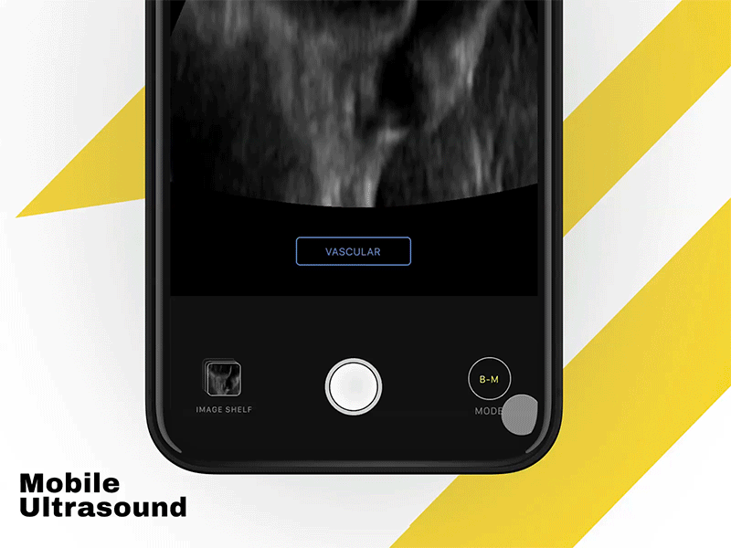 Experimental Component Mobile Ultrasound animation app components concept design experiement health care invision invision studio iphone iphone x mobile moove it ui ultrasound