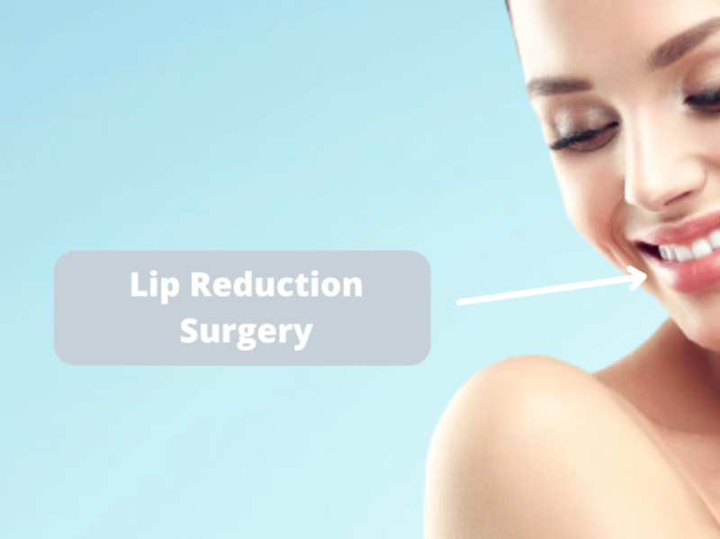 Lip Reduction Surgery In Delhi by homedoc on Dribbble