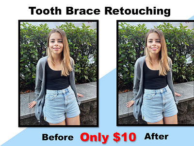 Tooth Brace Retouching best photoshop edit branding graphic design logo photo