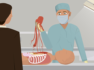 Heart Removal animation autopsy illustration motion people