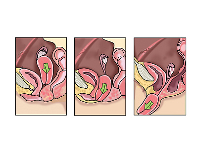 Medical Illustrations