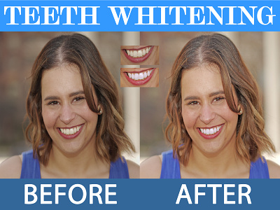 Teeth Whitening beauty retouching graphic design portrait retouching retouching skin retouching teeth whitening