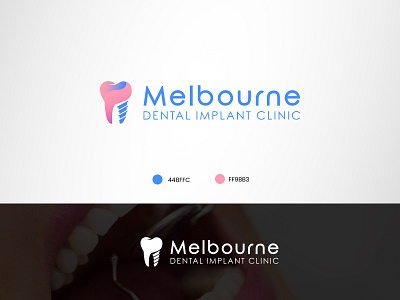 Dental Implant Logo branding design graphic design illustration logo vector