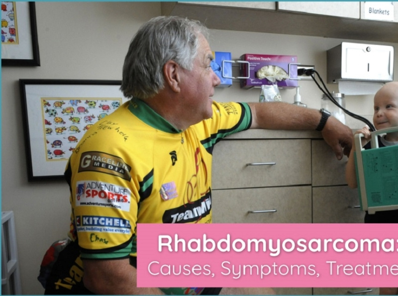 RHABDOMYOSARCOMA: CAUSES, SYMPTOMS, AND TREATMENT by University Cancer