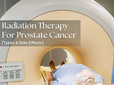 The Types Of Radiation Therapy For Prostate Cancer by University Cancer ...