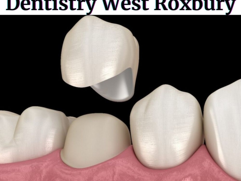 Get Services of Crown Dentistry West Roxbury