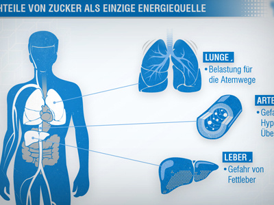 Infografik artery blue body fat human infographic liver lung medicine orangs sugar