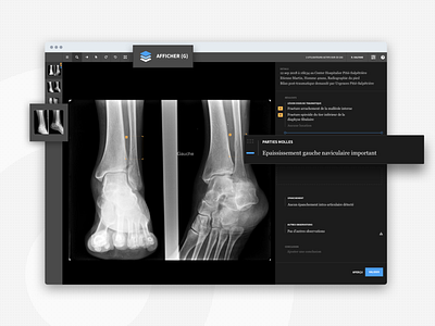 Automated report app app application clean design dribbble interface medical note popular product sketch tech ui uidesign ux uxdesign