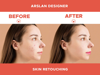 Skin Retouching