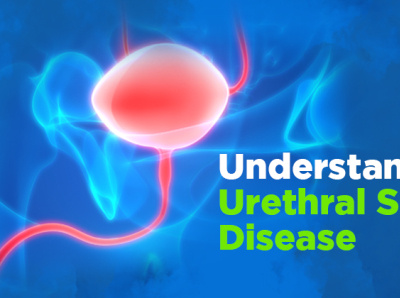 Dribbble - Understanding-Urethral-Stricture-Disease.jpg by regrow ...