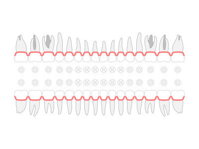 Smart Dental – teeth schema