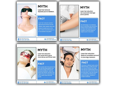 MYTH Laser Hair Removal 4 Posts