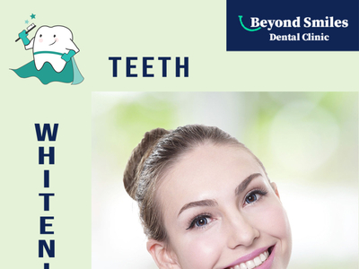 What is the cost of teeth whitening  in Bangalore?