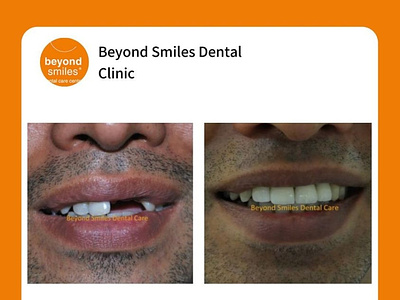 Where is the Beyond smile Dental Clinic in Koramangala?