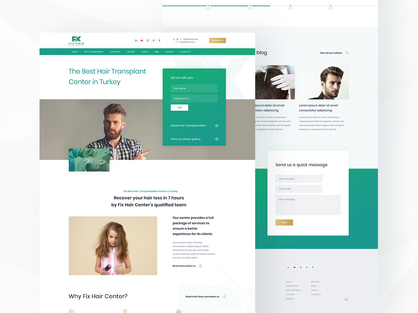 Fix Hair Istanbul site by Obada Qawwas 🇵🇸🇺🇦 on Dribbble