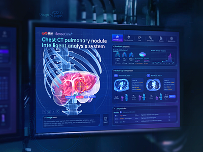 Sensetime-Chest CT pulmonary nodule intelligent analysis system hud