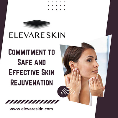 Elevare Skin's Commitment to Safe Skin Rejuvenation antiaging elevareskin elevareskinreviews skincare skinhealth