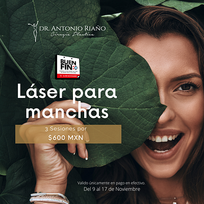 Promocional Laser branding graphic design
