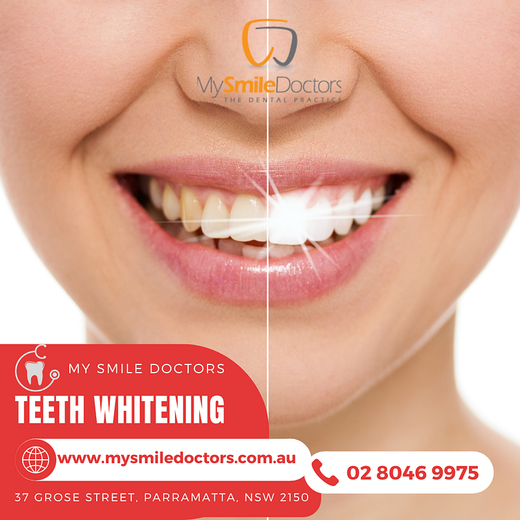 effective-ways-to-whiten-your-teeth-at-home-by-arogya-formulations-pvt